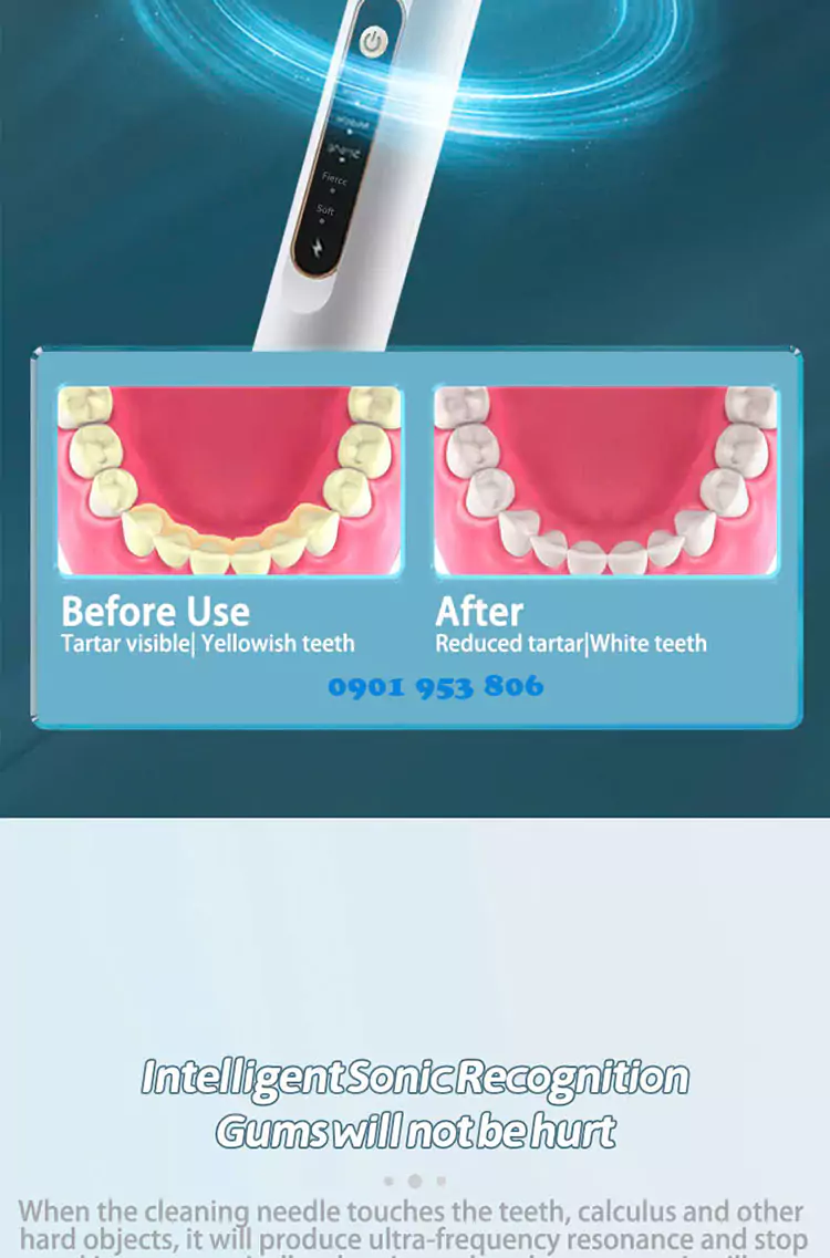 Máy lấy cao răng tại nhà mini 04