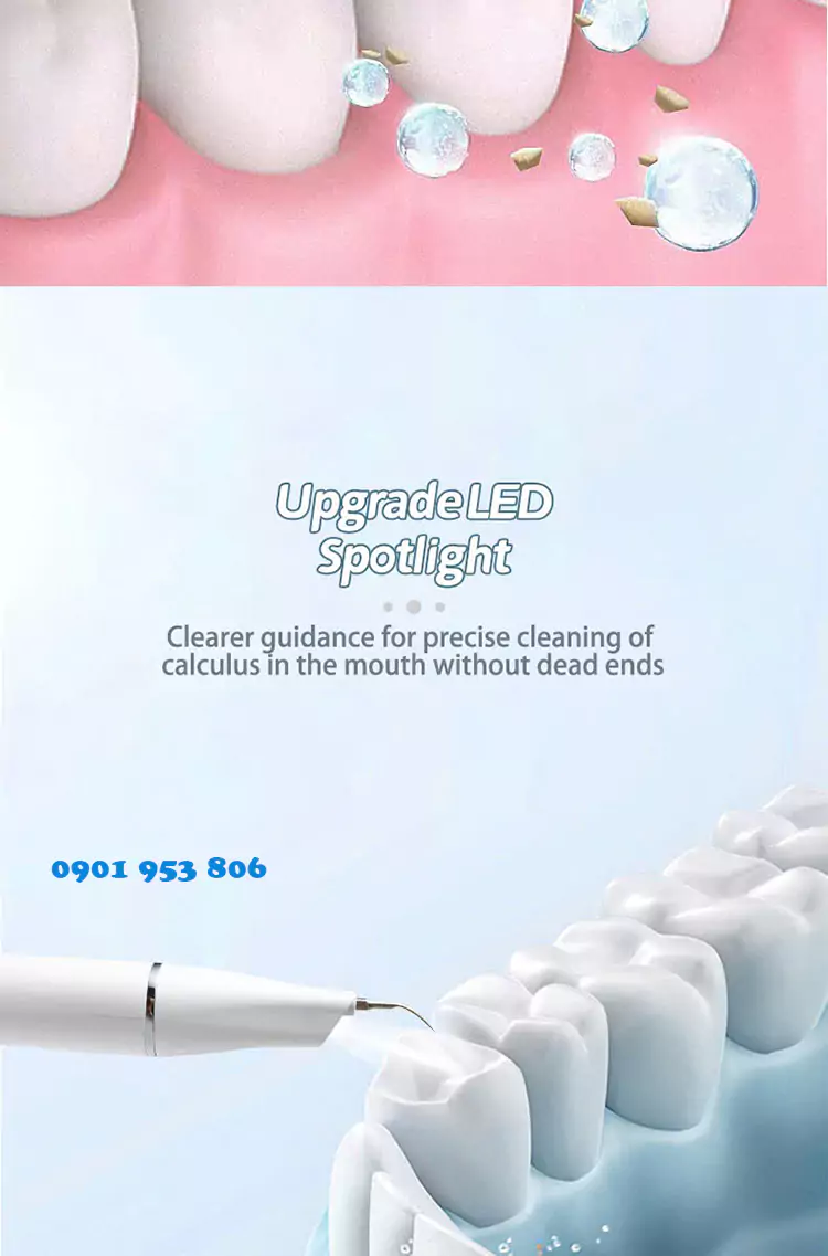 Máy lấy cao răng tại nhà mini 06